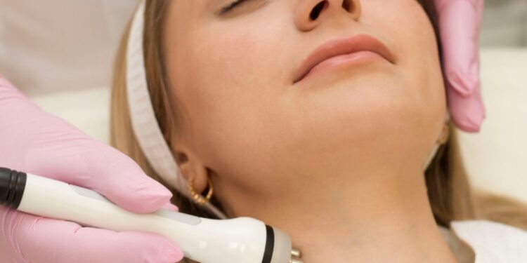 one stitch facelift advantages