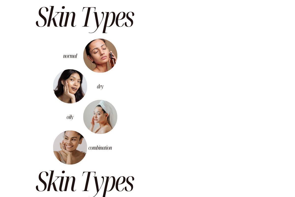 skin types