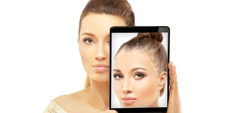 hair implants for women